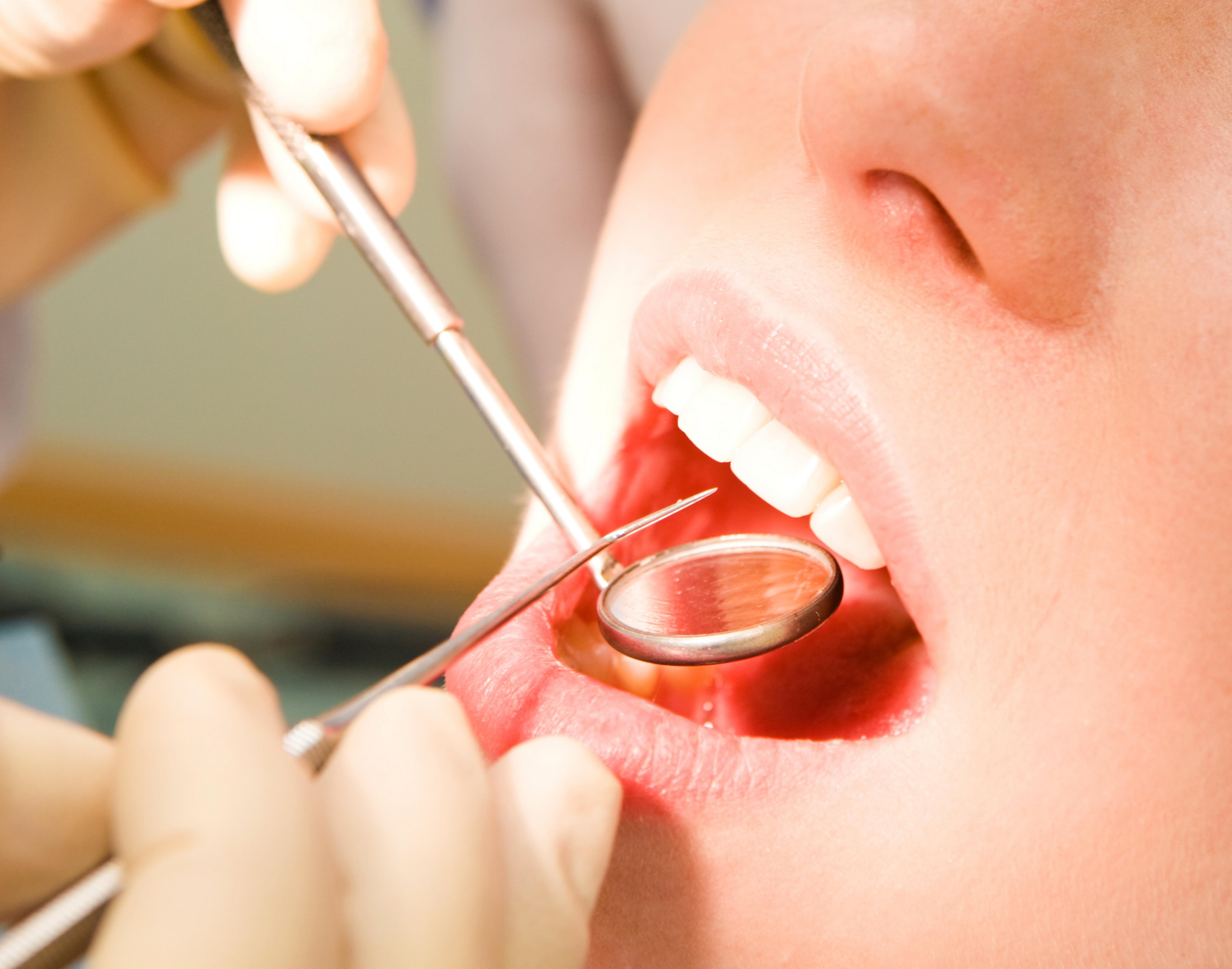 Оценка состояния полости рта. Осмотр полости рта в стоматологии. Осмотр полости рта у стоматолога. Обследование слизистой оболочки полости рта.