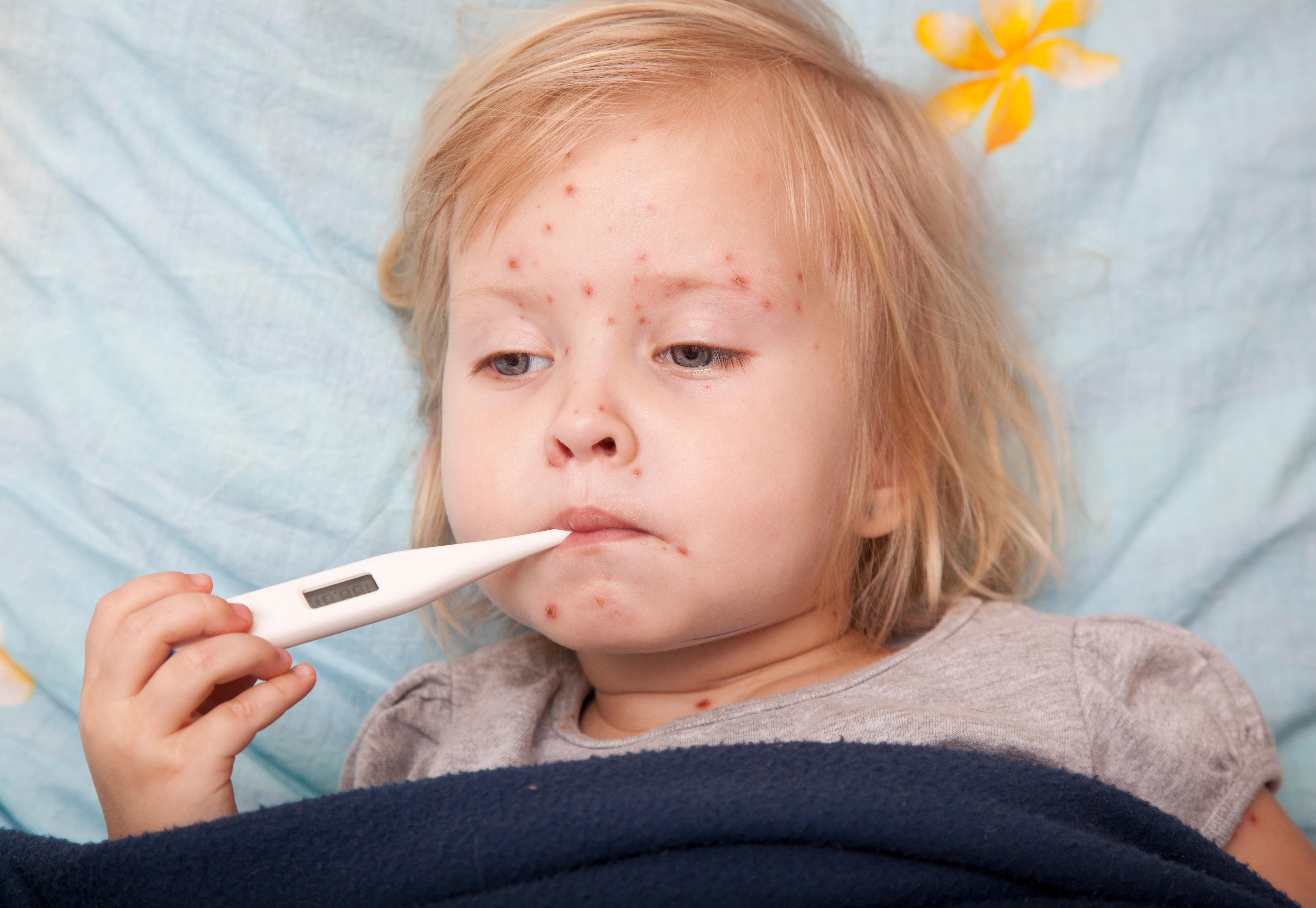 hand-foot-mouth-disease-family-medical-practice